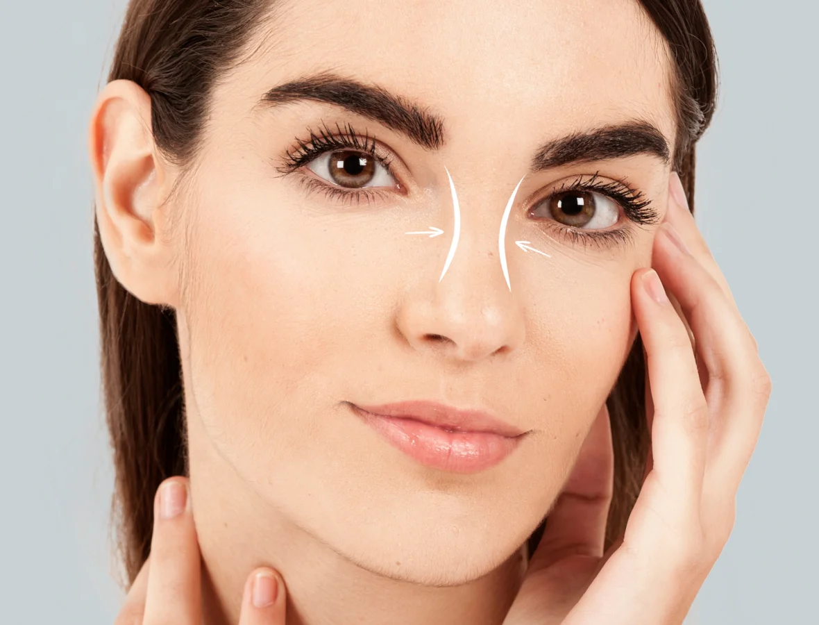 Rhinoplastie, chirurgie esthétique du nez à Marseille - Dr Jauffret