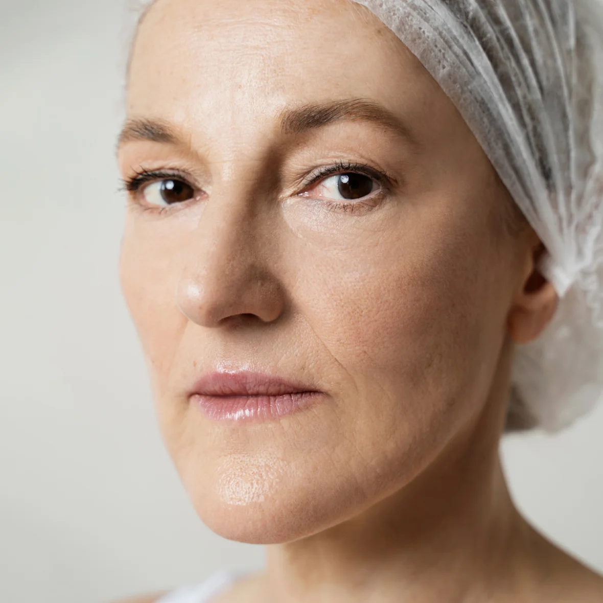 Visage après un lifting - Dr Jauffret, Marseille