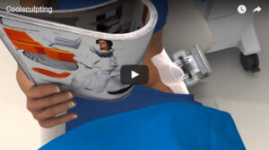 coolsculpting à Marseille - Dr JL Jauffret